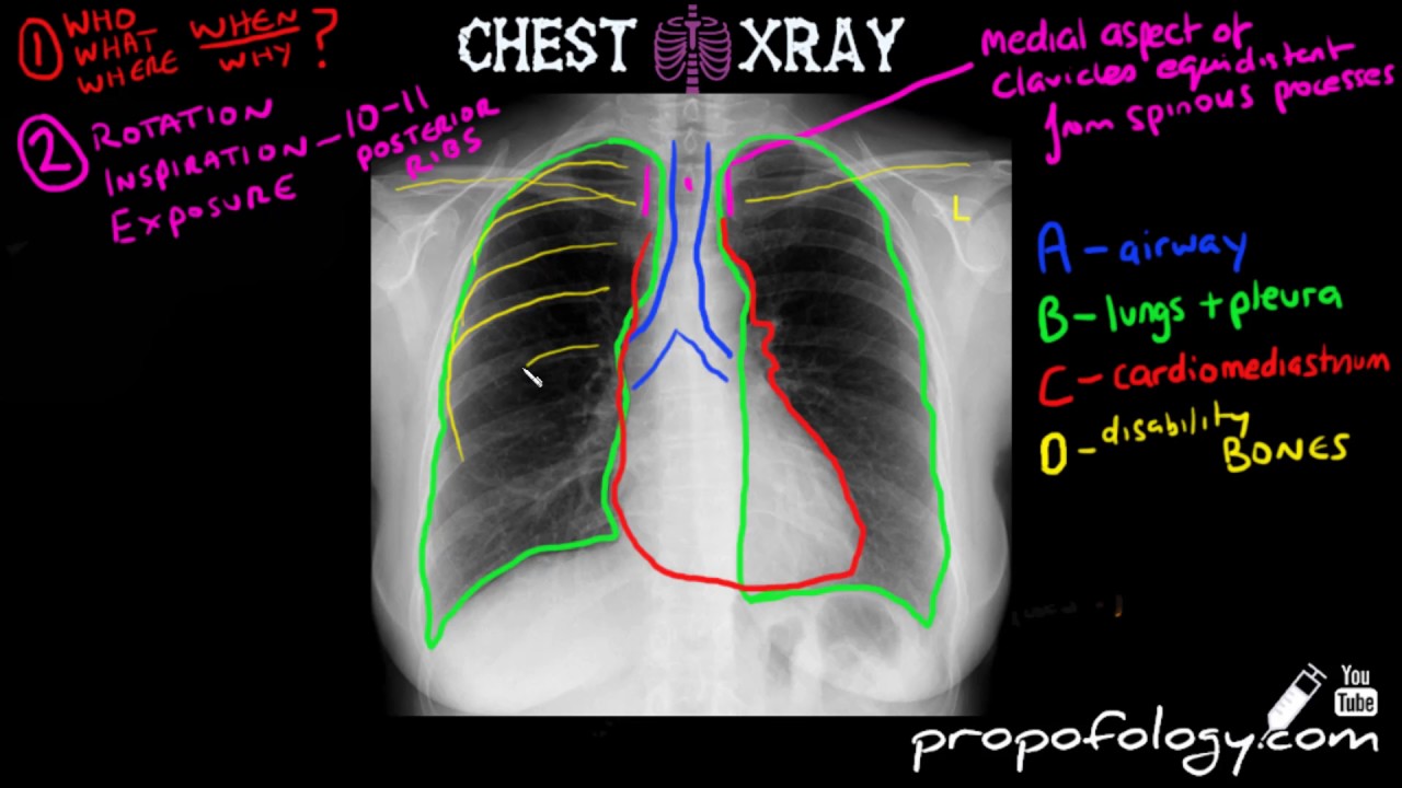 X ray reading software